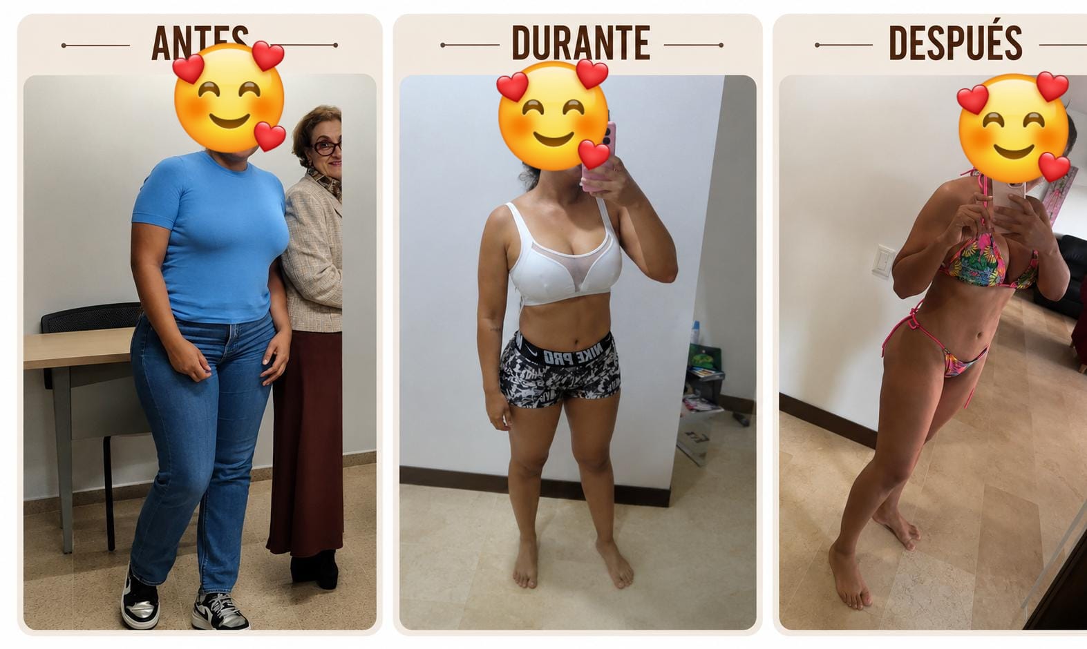 Caso real — antes, durante y después