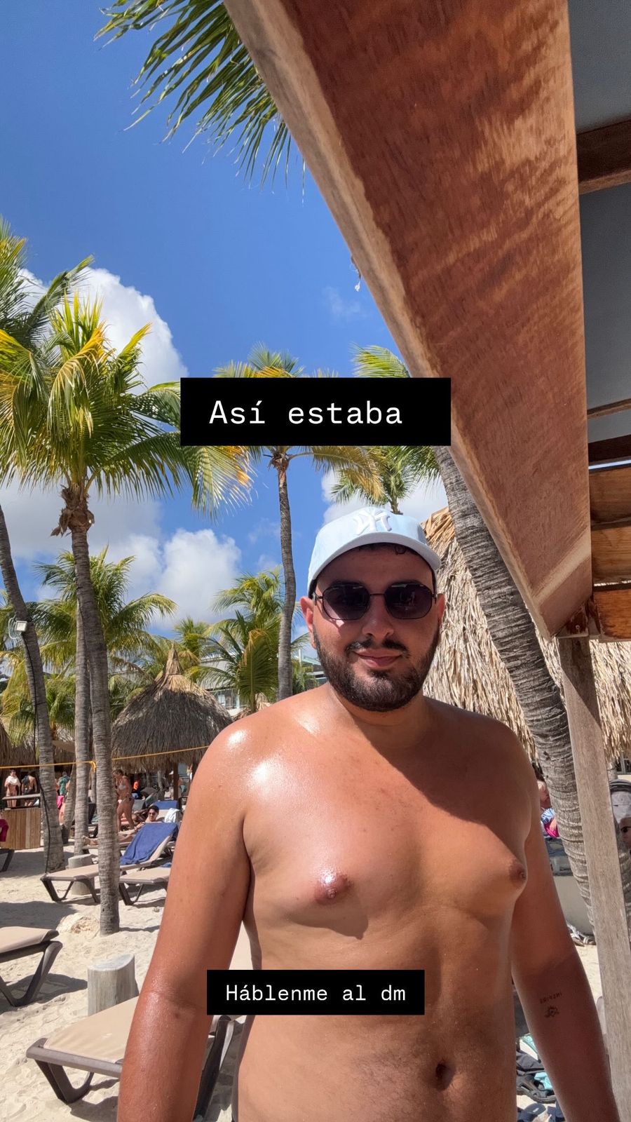 Antes